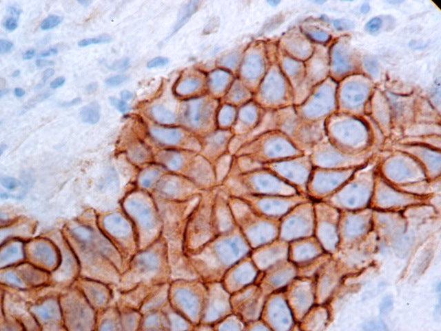 Beta-Catenin