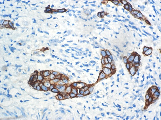 CA15-3