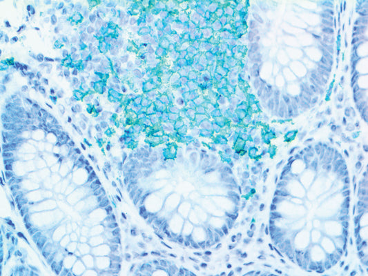 CD3 Epsilon