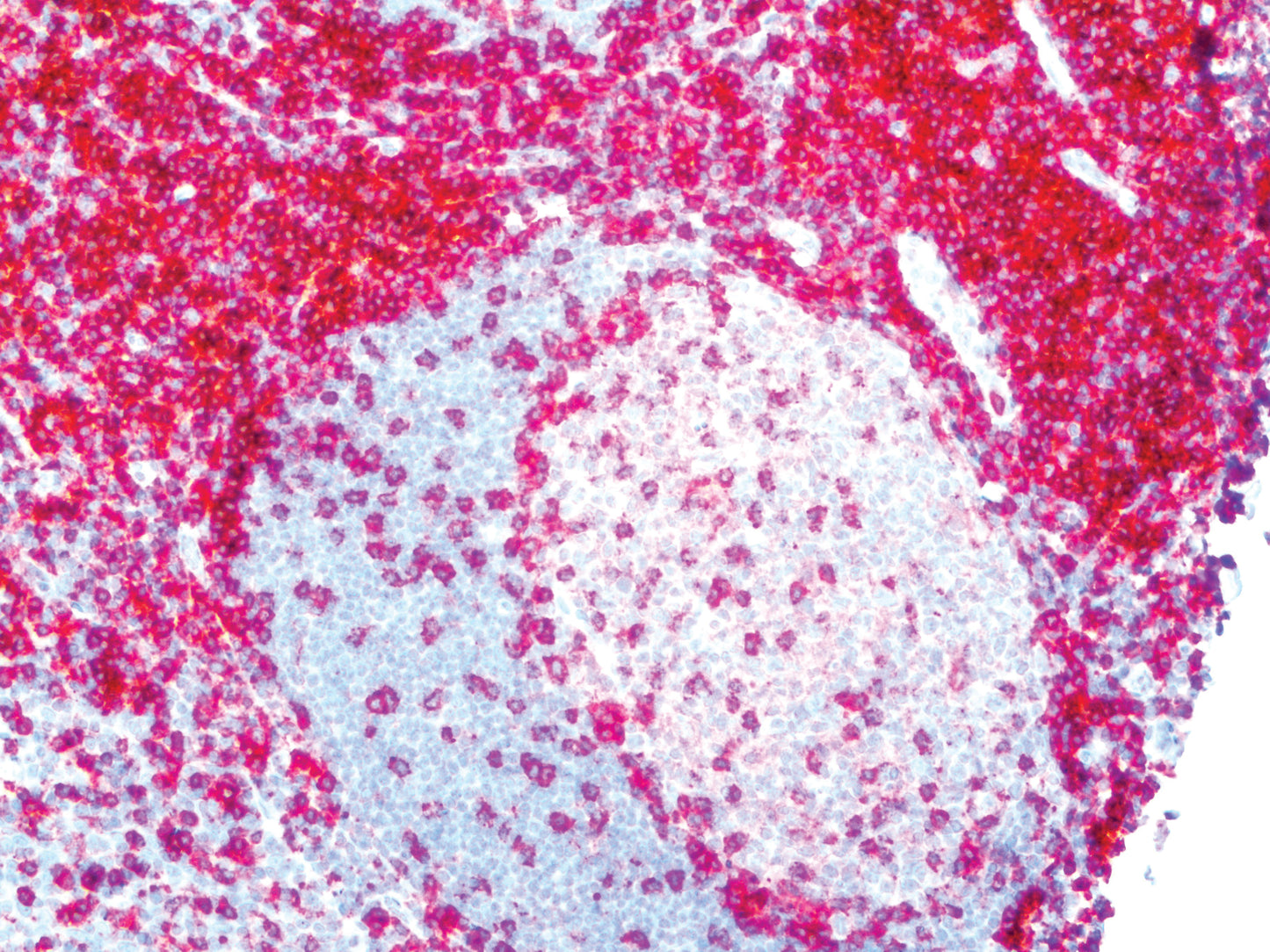 CD4