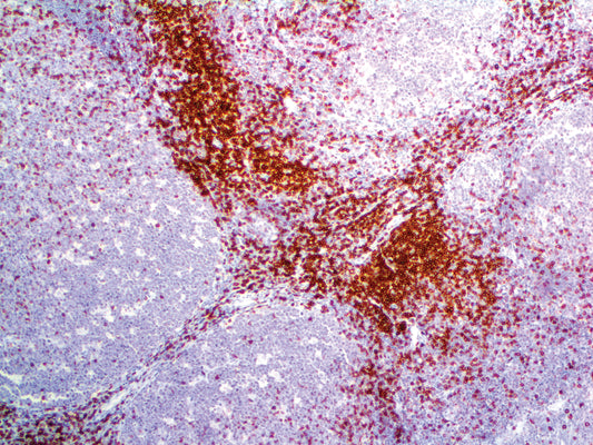 CD7