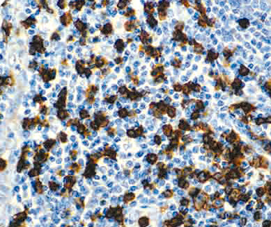 CD8