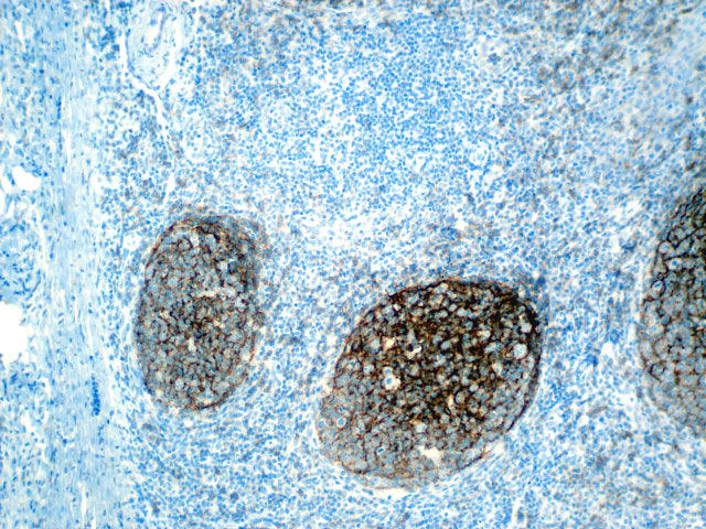 CD21