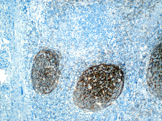 CD21