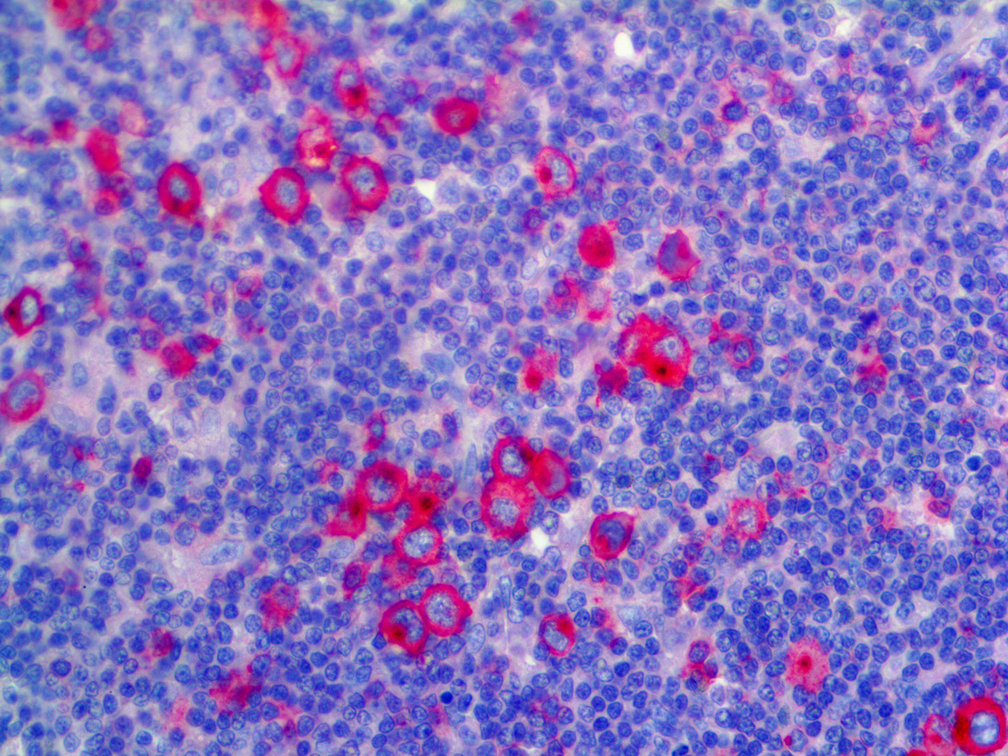 CD30