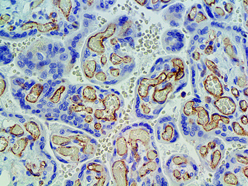 CD31