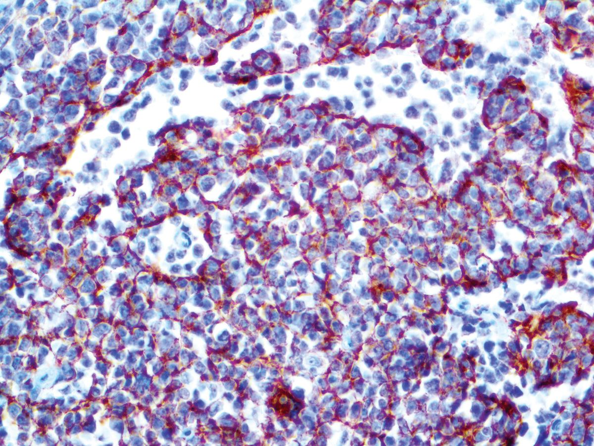 CD35