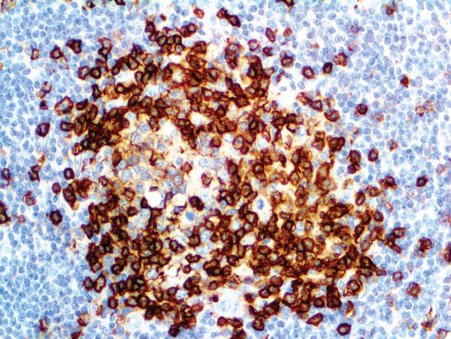 CD43