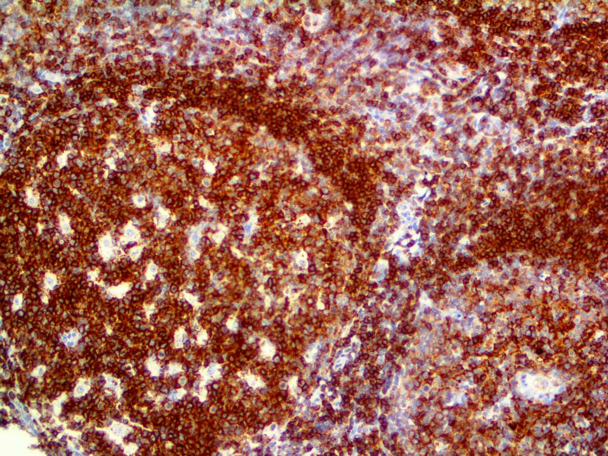 CD45RA