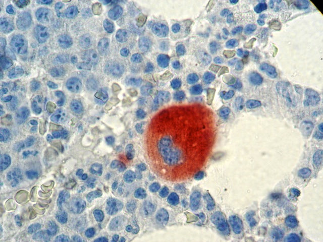 CD61