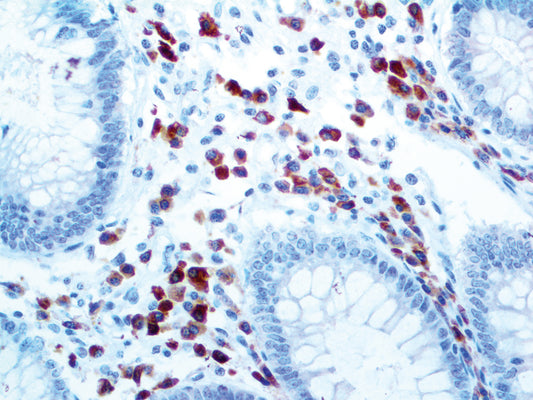CD79a