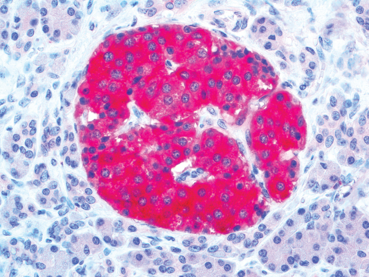 Chromogranin A
