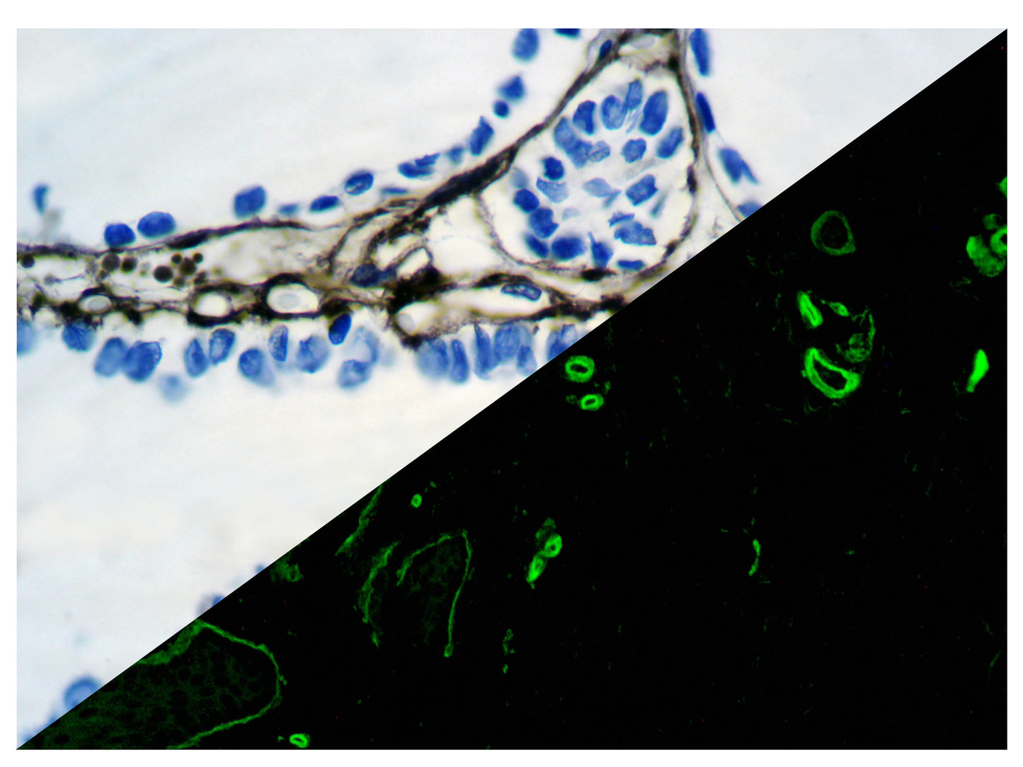 Collagen Type IV