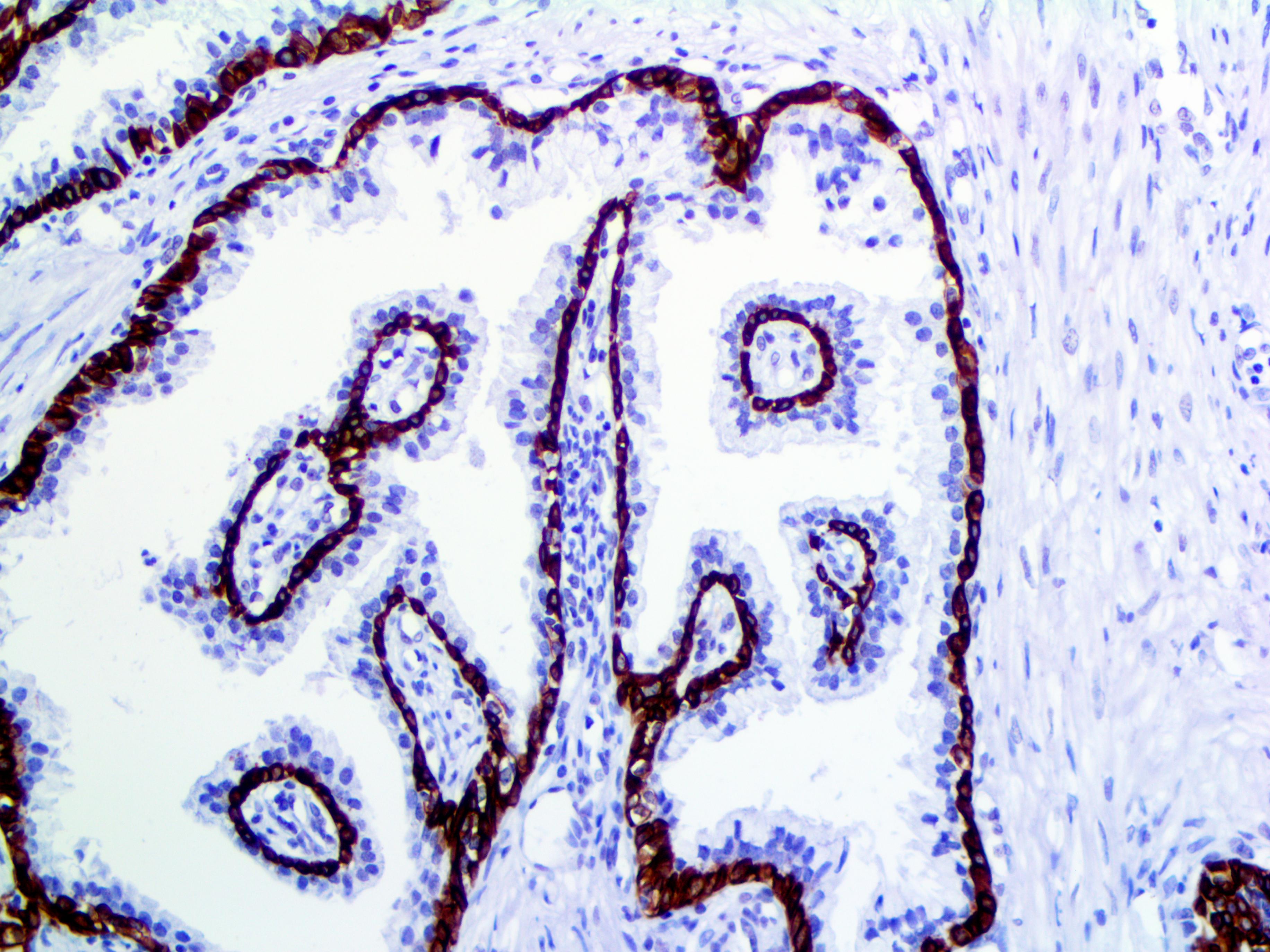 Cytokeratin 5 & 6 D5 & 16B4 | Bio SB
