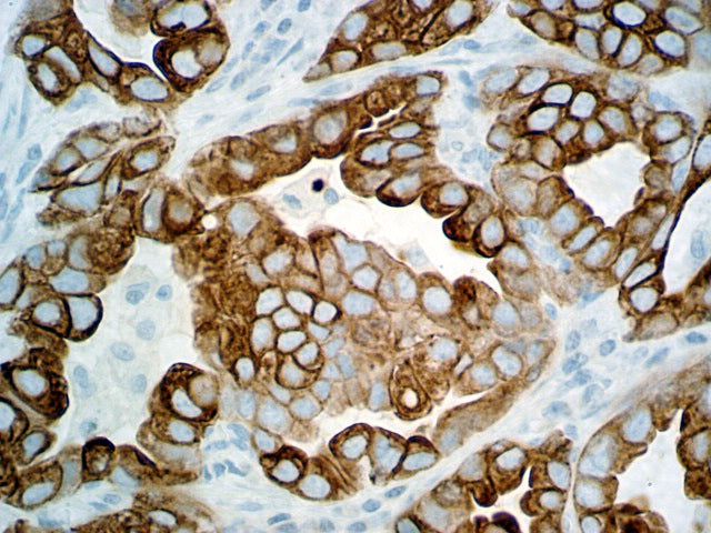 Cytokeratin 7