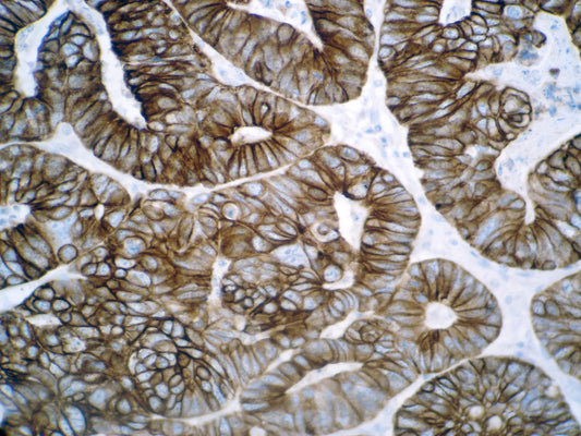 Cytokeratin 8 & 18