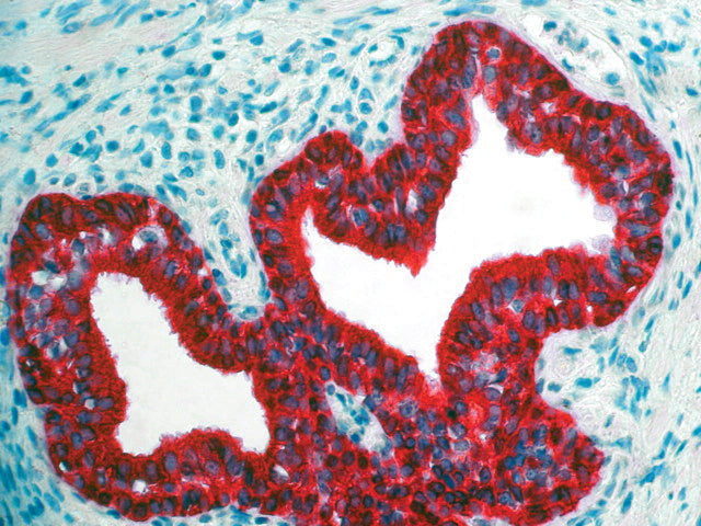 Cytokeratin 35BH11