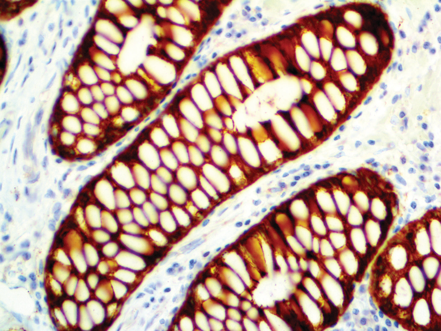 Cytokeratin Cocktail AE1 & AE3