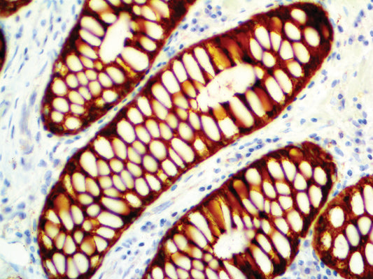 Cytokeratin Cocktail AE1 & AE3