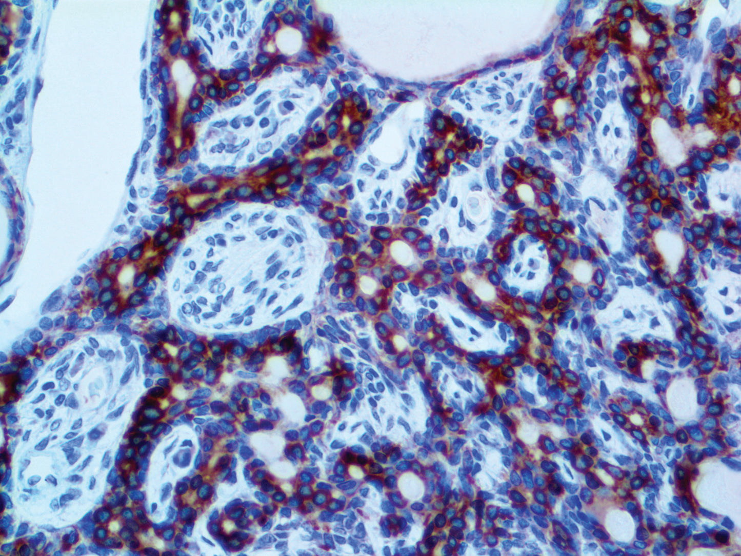 Cytokeratin LMW AE1