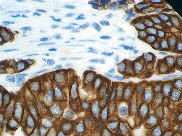 Cytokeratin HMW AE3