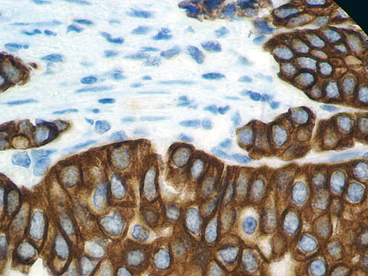 Cytokeratin HMW AE3