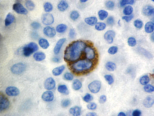 Epstein Barr Virus LMP-1