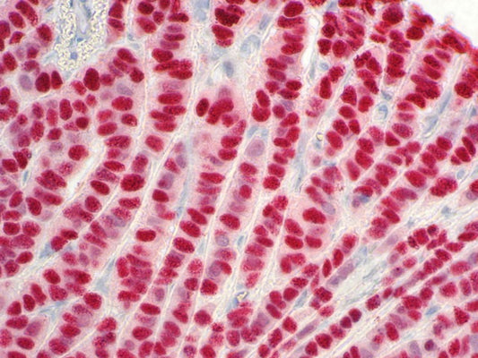 Estrogen Receptor