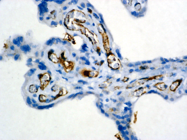 Factor VIII-Related Antigen