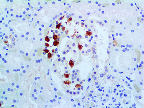 Galectin-3