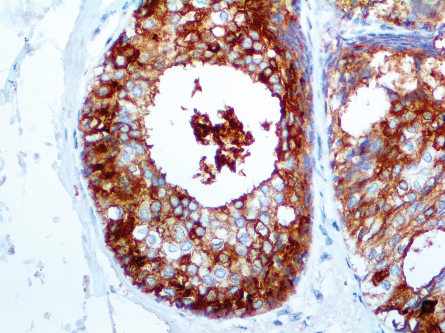 GCDFP-15