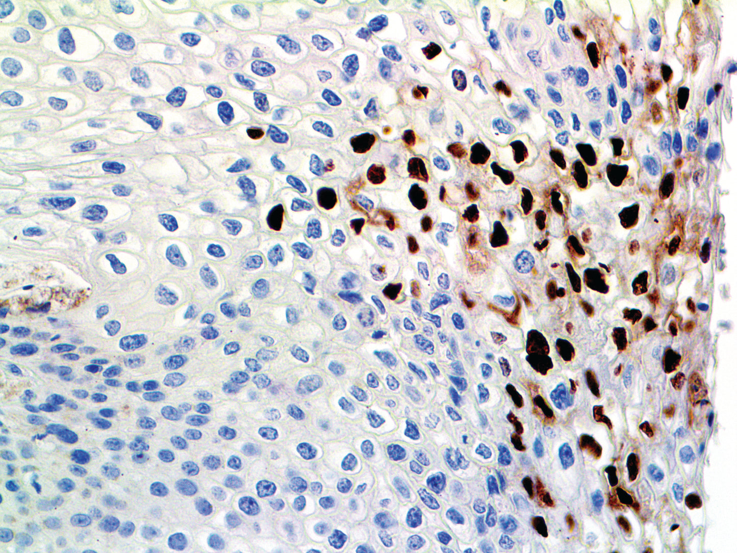 HPV
