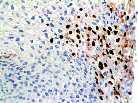 HPV