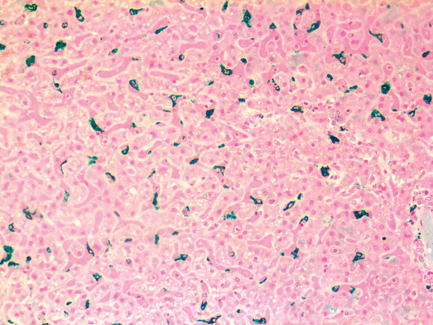 Macrophage HAM-56