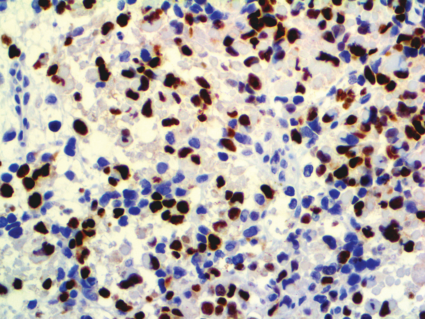 Myogenin