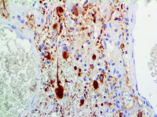 Neurofilament