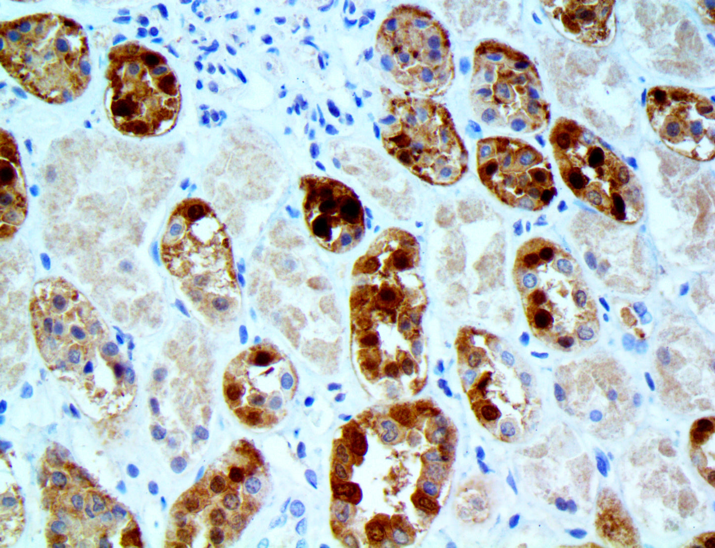 Parvovirus