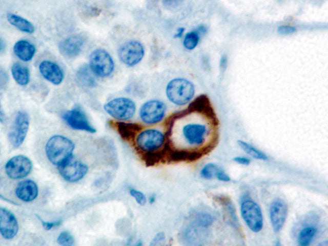 Prolactin