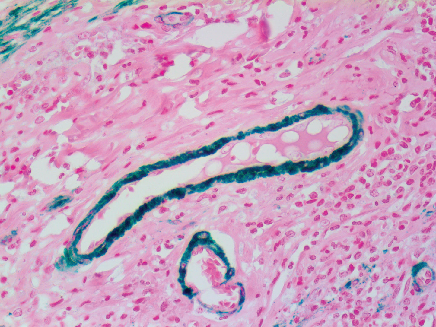 Myosin Smooth Muscle