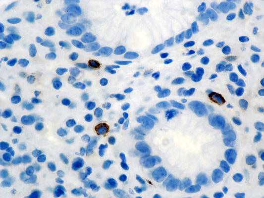 Tryptase