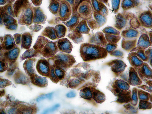 Tyrosinase