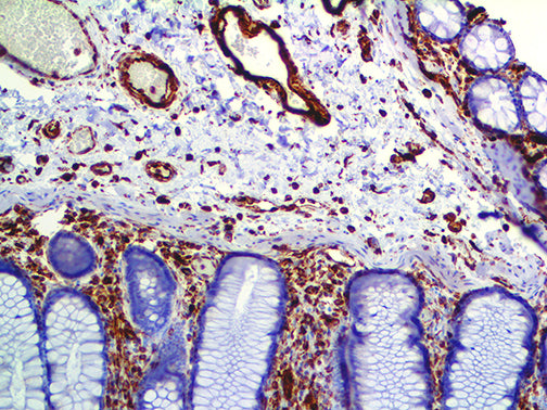 Vimentin