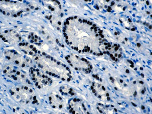 Androgen Receptor