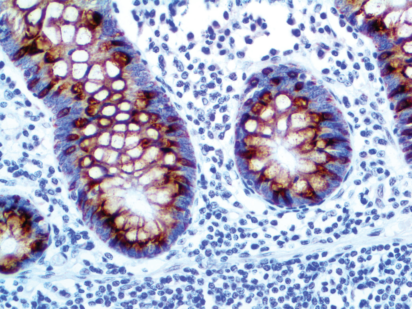 MUC2