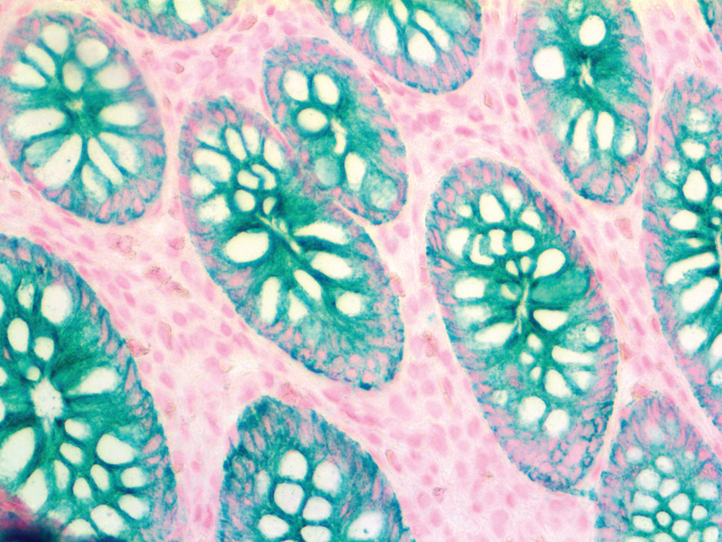 Cytokeratin OSCAR