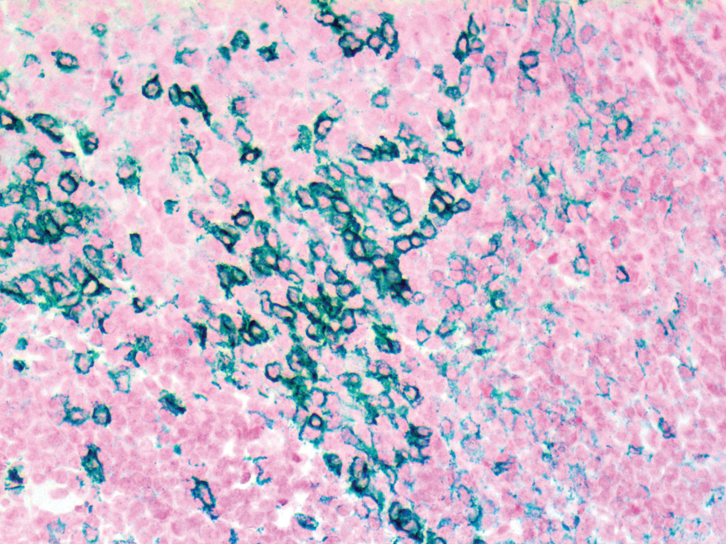 PD-1/CD279