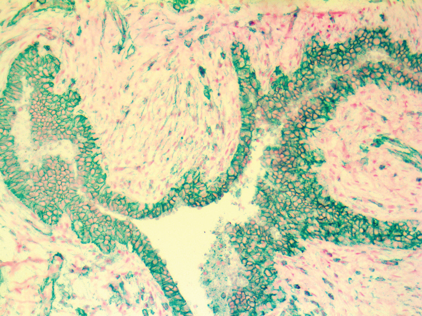 CD44
