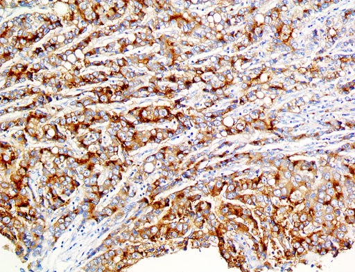 Glypican-3