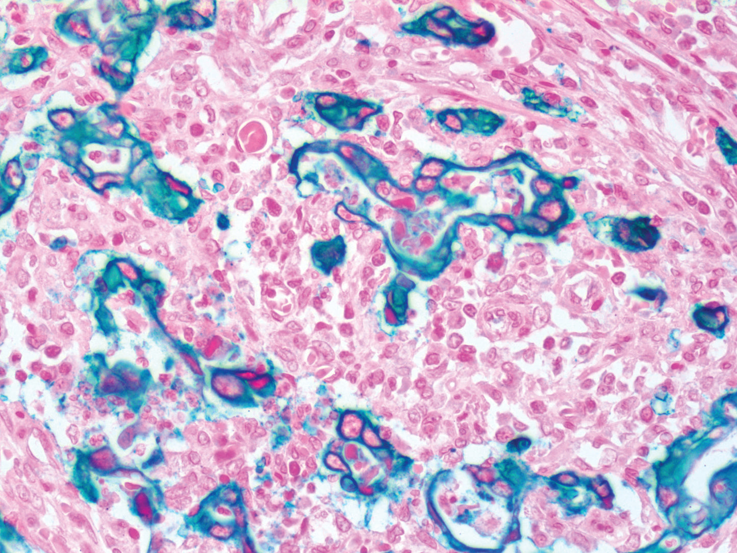 EpCAM\Epithelial Specific Antigen