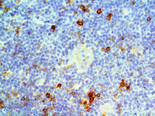 CD25